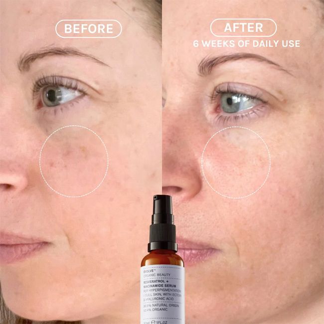 Evolve Beauty's Resveratrol + Niacinamide Organic anti-age lifting serum Beauty