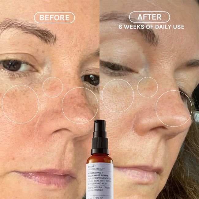 Evolve Beauty's Resveratrol + Niacinamide Organic anti-age lifting serum Skincare