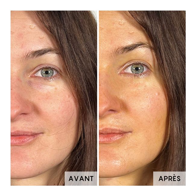 Sérum visage anti-âge Concentré d'églantier Oden Résultats