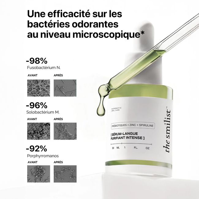 Sérum dentaire Langue Purifiant Intense The Smilist Résultats