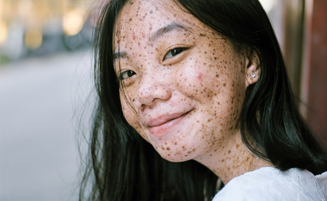 Soin visage adolescent